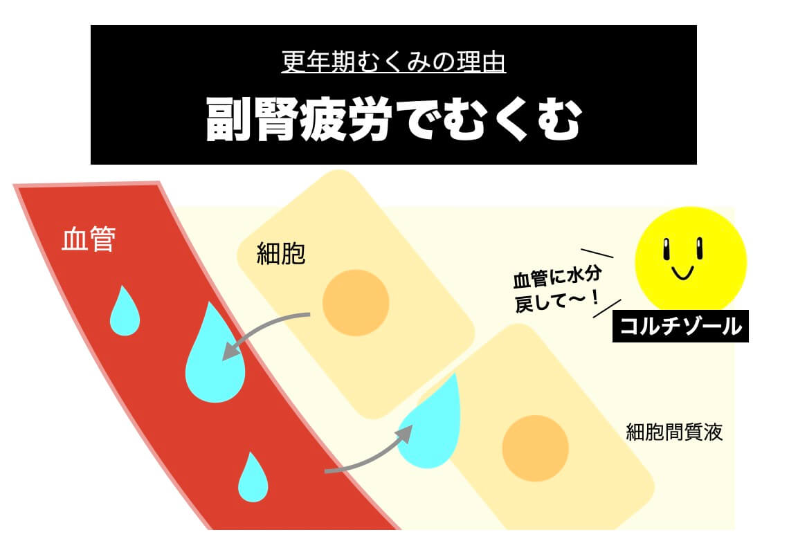 副腎疲労とむくみの関係を示した図