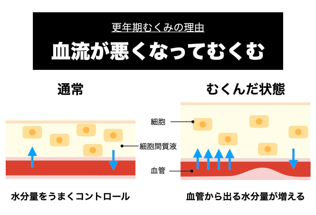 更年期がなぜ浮腫のかを説明している図