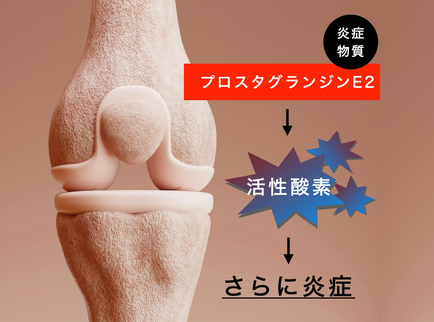 膝の痛みを作るプロスタグランジンの説明をしている図
